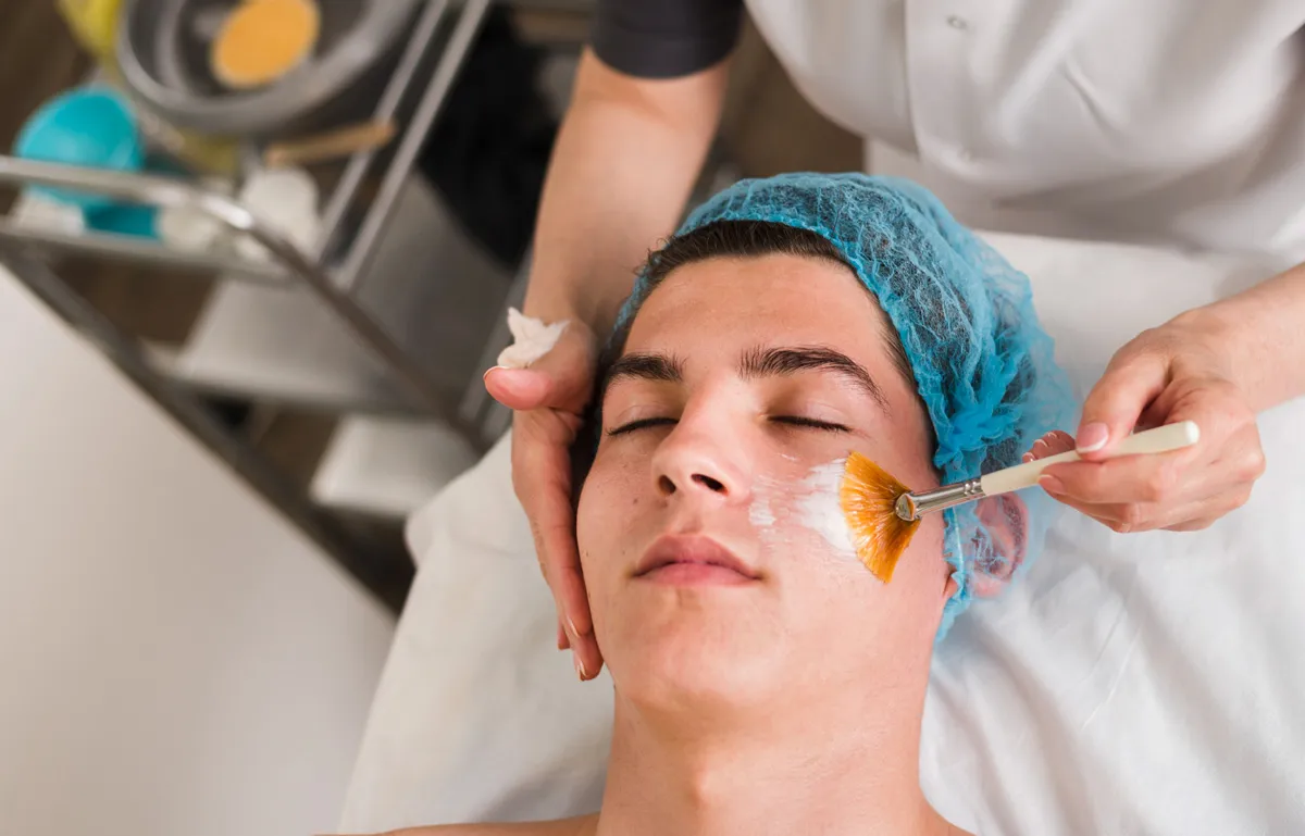Chemical Peel