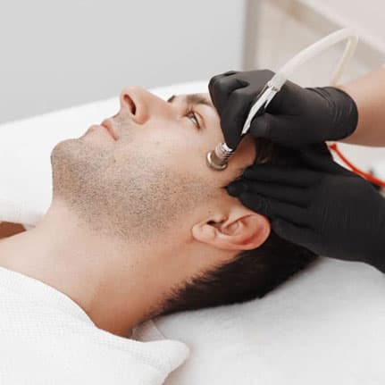 Microdermabrasion